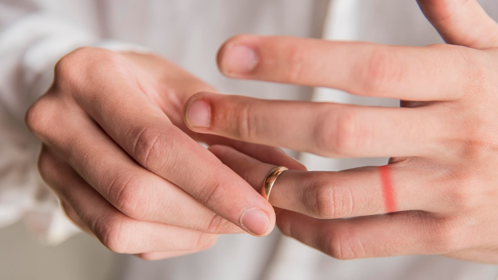 Hand removing a ring, showing an indent on the finger.